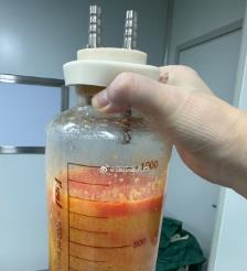 枣庄水动力吸脂手术要做多久？
